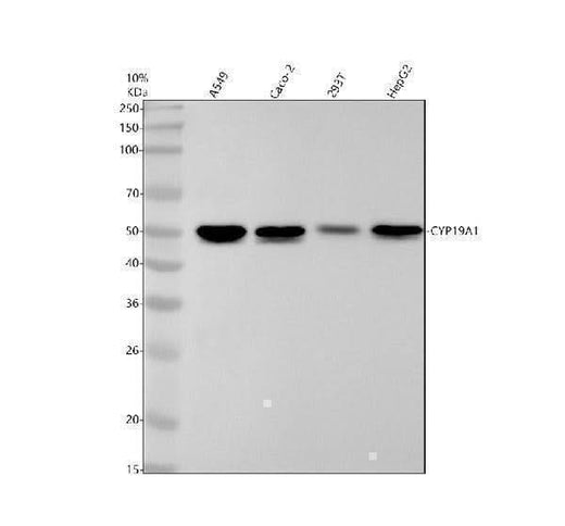 Anti-Aromatase CYP19A1 Rabbit Monoclonal Antibody Boster Bio