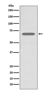 Anti-beta 2 Adrenergic Receptor ADRB2 Rabbit Monoclonal Antibody Boster Bio