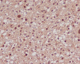 Anti-FoxO1a Rabbit Monoclonal Antibody Boster Bio