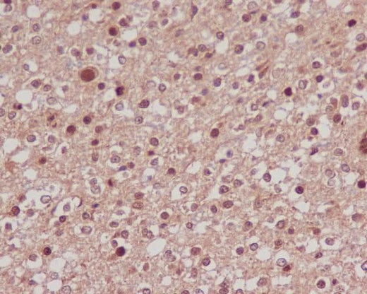 Anti-FoxO1a Rabbit Monoclonal Antibody Boster Bio
