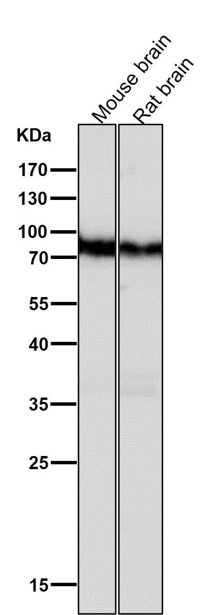 Anti-B Raf Rabbit Monoclonal Antibody Boster Bio