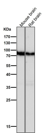 Anti-B Raf Rabbit Monoclonal Antibody Boster Bio
