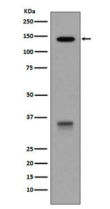 Anti-LDL Receptor Rabbit Monoclonal Antibody Boster Bio