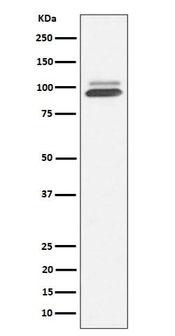 Anti-Nrf2 NFE2L2 Rabbit Monoclonal Antibody Boster Bio