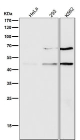 Anti-pro Caspase 9 CASP9 Rabbit Monoclonal Antibody Boster Bio
