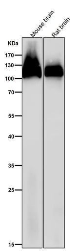 Anti-Amyloid beta A4 APP Rabbit Monoclonal Antibody Boster Bio