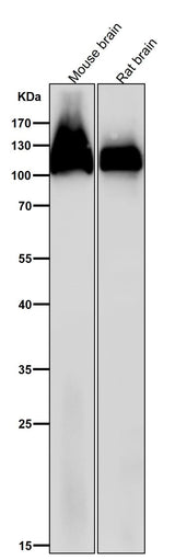 Anti-Amyloid beta A4 APP Rabbit Monoclonal Antibody Boster Bio
