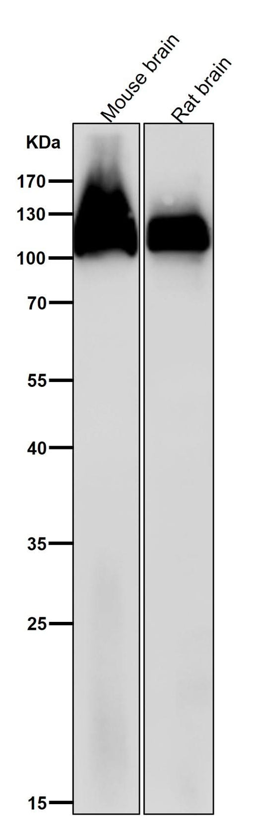 Anti-Amyloid beta A4 APP Rabbit Monoclonal Antibody Boster Bio