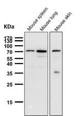 Anti-Cox2 PTGS2 Monoclonal Antibody Boster Bio