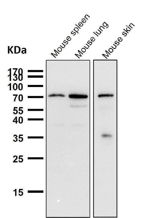Anti-Cox2 PTGS2 Monoclonal Antibody Boster Bio