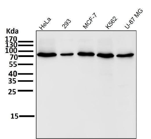 Anti-COX2 PTGS2 Rabbit Monoclonal Antibody Boster Bio