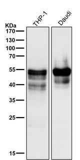 Anti-RUNX1/RUNX2/RUNX3 Rabbit Monoclonal Antibody Boster Bio