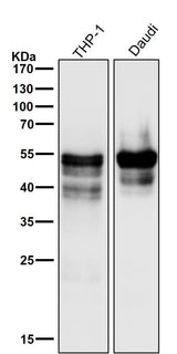 Anti-RUNX1/RUNX2/RUNX3 Rabbit Monoclonal Antibody Boster Bio