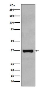 Anti-Rad51 Rabbit Monoclonal Antibody Boster Bio