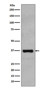 Anti-Rad51 Rabbit Monoclonal Antibody Boster Bio