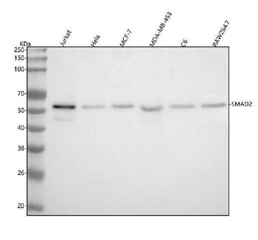 Anti-Smad2 Rabbit Monoclonal Antibody Boster Bio