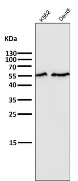 Anti-Smad2 Rabbit Monoclonal Antibody Boster Bio