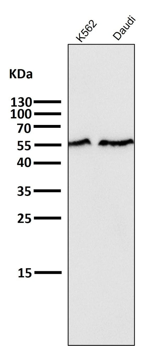 Anti-Smad2 Rabbit Monoclonal Antibody Boster Bio