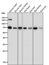 Anti-PML Rabbit Monoclonal Antibody Boster Bio