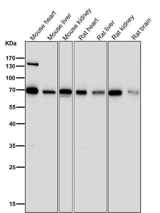 Anti-PML Rabbit Monoclonal Antibody Boster Bio