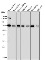 Anti-PML Rabbit Monoclonal Antibody Boster Bio
