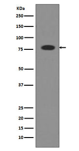 Anti-Transferrin TF Rabbit Monoclonal Antibody Boster Bio