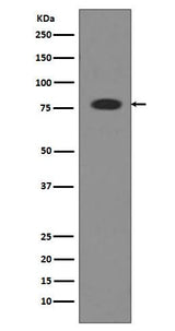 Anti-Transferrin TF Rabbit Monoclonal Antibody Boster Bio