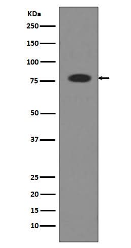 Anti-Transferrin TF Rabbit Monoclonal Antibody Boster Bio