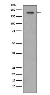 Anti-PDGF Receptor beta PDGFRB Rabbit Monoclonal Antibody Boster Bio