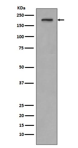 Anti-PDGF Receptor beta PDGFRB Rabbit Monoclonal Antibody Boster Bio
