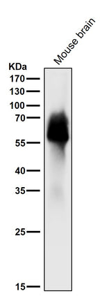 Anti-Tau MAPT Rabbit Monoclonal Antibody Boster Bio