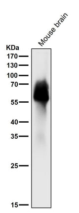 Anti-Tau MAPT Rabbit Monoclonal Antibody Boster Bio