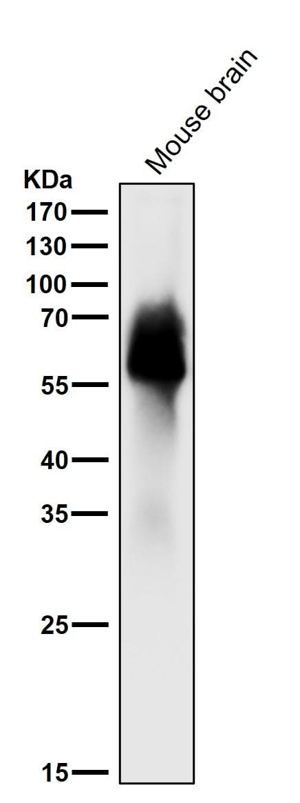 Anti-Tau MAPT Rabbit Monoclonal Antibody Boster Bio