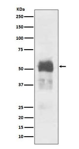 Anti-Tau MAPT Rabbit Monoclonal Antibody Boster Bio