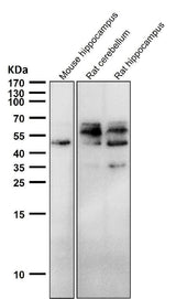 Anti-Phospho-Tau (S198) Rabbit Monoclonal Antibody Boster Bio