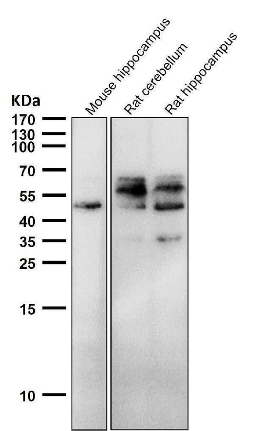Anti-Phospho-Tau (S198) Rabbit Monoclonal Antibody Boster Bio