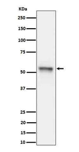 Anti-Phospho-Tau (S199) Rabbit Monoclonal Antibody Boster Bio