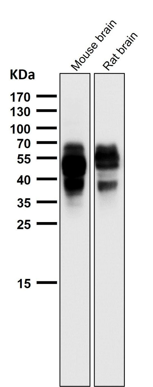 Anti-Phospho-Tau (S202) Rabbit Monoclonal Antibody Boster Bio