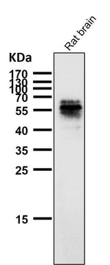 Anti-Phospho-Tau (S214) Rabbit Monoclonal Antibody Boster Bio