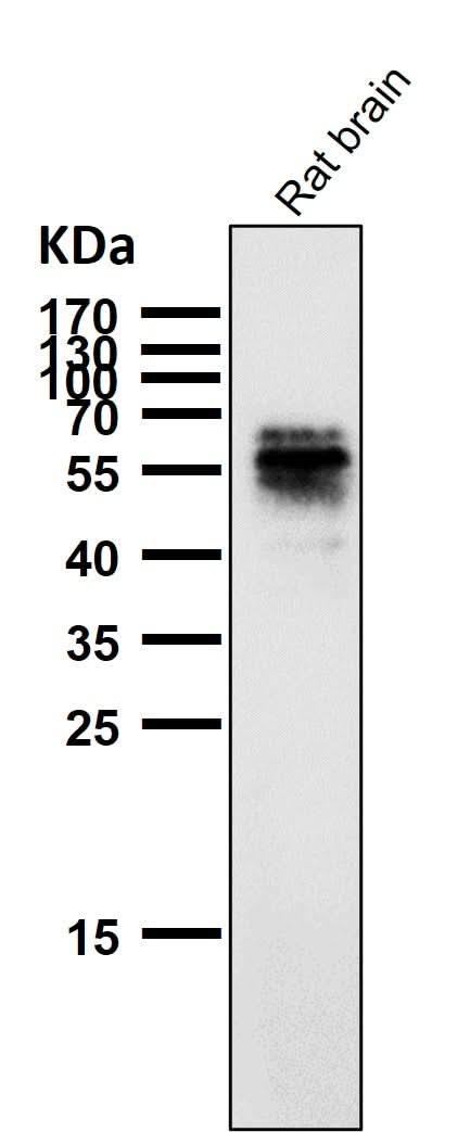Anti-Phospho-Tau (S214) Rabbit Monoclonal Antibody Boster Bio