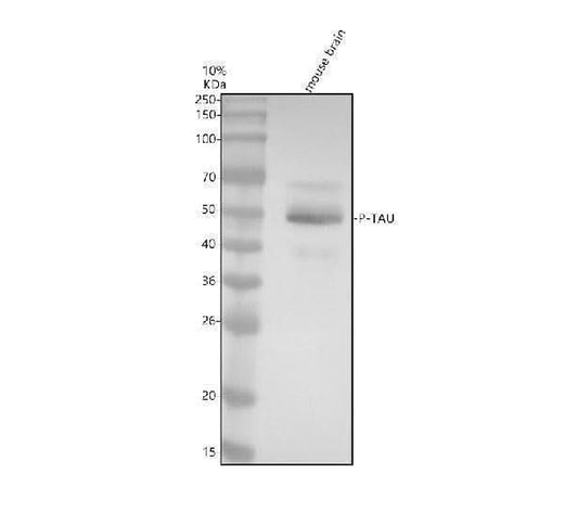 Anti-Phospho-Tau (S404) Rabbit Monoclonal Antibody Boster Bio