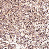 Anti-FGFR1 Rabbit Monoclonal Antibody Boster Bio