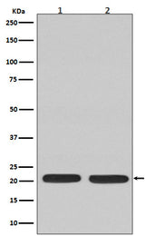 Anti-Ras NRAS Rabbit Monoclonal Antibody Boster Bio