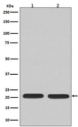 Anti-Ras NRAS Rabbit Monoclonal Antibody Boster Bio