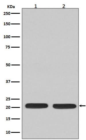 Anti-Ras NRAS Rabbit Monoclonal Antibody Boster Bio
