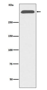 Anti-ApoB/Apolipoprotein B Rabbit Monoclonal Antibody Boster Bio