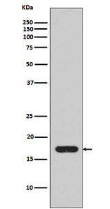 Anti-IL1 beta Rabbit Monoclonal Antibody Boster Bio