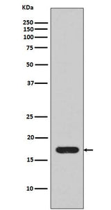 Anti-IL1 beta Rabbit Monoclonal Antibody Boster Bio