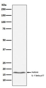 Anti-IL-1 beta Rabbit Monoclonal Antibody Boster Bio