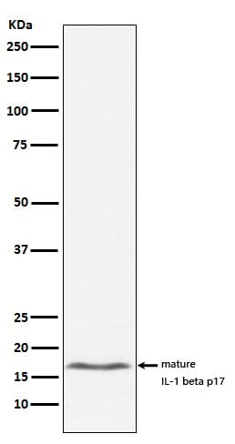 Anti-IL-1 beta Rabbit Monoclonal Antibody Boster Bio